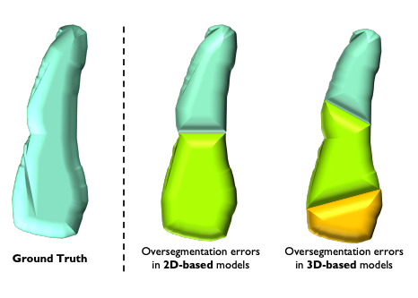 Publication figure for 3D Cell Oversegmentation Correction via Geo-Wasserstein Divergence
