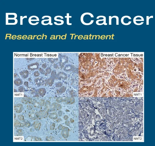 Publication figure for Investigation of neoadjuvant endocrine therapy for the treatment of preinvasive breast lesions using patient-derived organoids