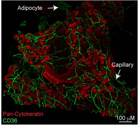 Publication figure for Loss of PPARγ activity characterizes early protumorigenic stromal reprogramming and dictates the therapeutic window of opportunity
