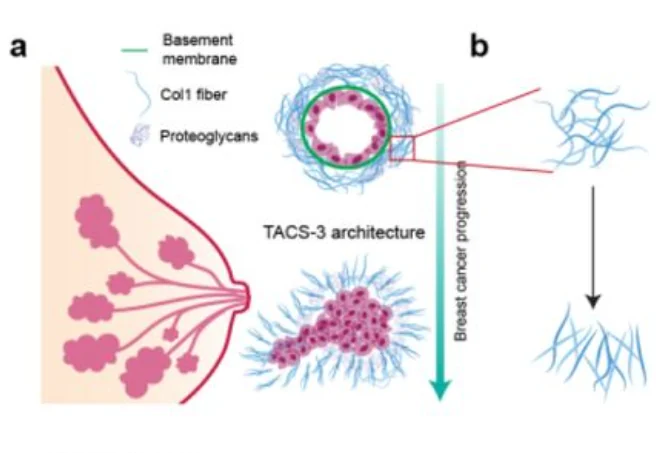 Publication figure for Swirling motion of breast cancer cells radially aligns collagen fibers to enable collective invasion